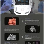 OEM/ODM Services 74 3D4D Ultrasound Machine Doppler Medical 6