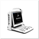 OEM/ODM Services 60 Chison ultrasoundDoppler Chison ultrasound ECO3exp 5