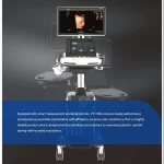OEM/ODM Services 52 Sonoscape P11 Elite OB Trolley 4D Color Doppler Ultrasound Machine 4