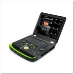 OEM/ODM Services 1 Static 3D 4D doppler ultrasound imaging 1