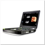 OEM/ODM Services 21 Static 3D 4D doppler ultrasound imaging 2