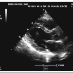OEM/ODM Services 22 Static 3D 4D doppler ultrasound imaging 6