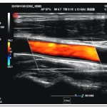 OEM/ODM Services 23 Static 3D 4D doppler ultrasound imaging 7