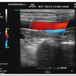 OEM/ODM Services 24 Static 3D 4D doppler ultrasound imaging 8