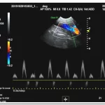 OEM/ODM Services 25 Static 3D 4D doppler ultrasound imaging 9