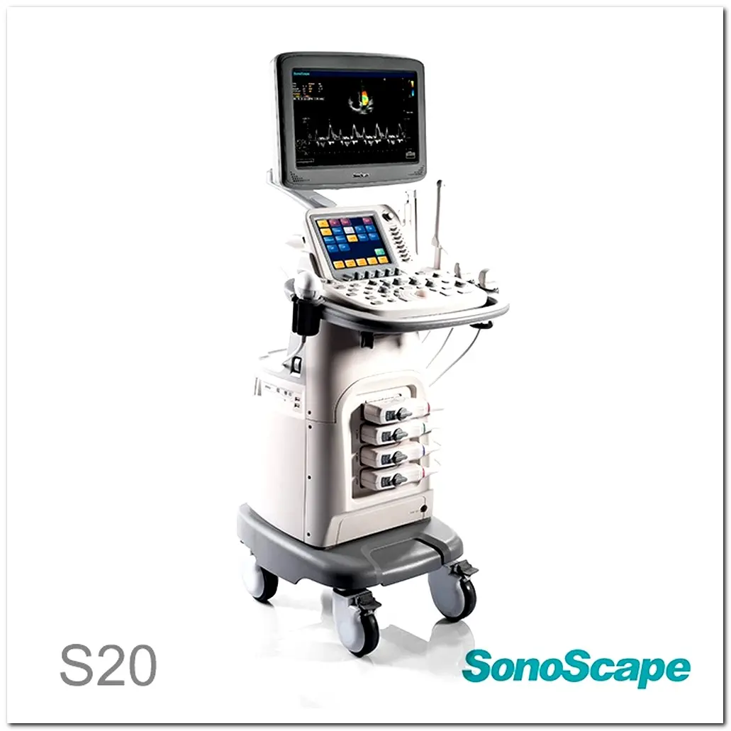 MONKON Colour Doppler Ultrasound in Pregnancy 13