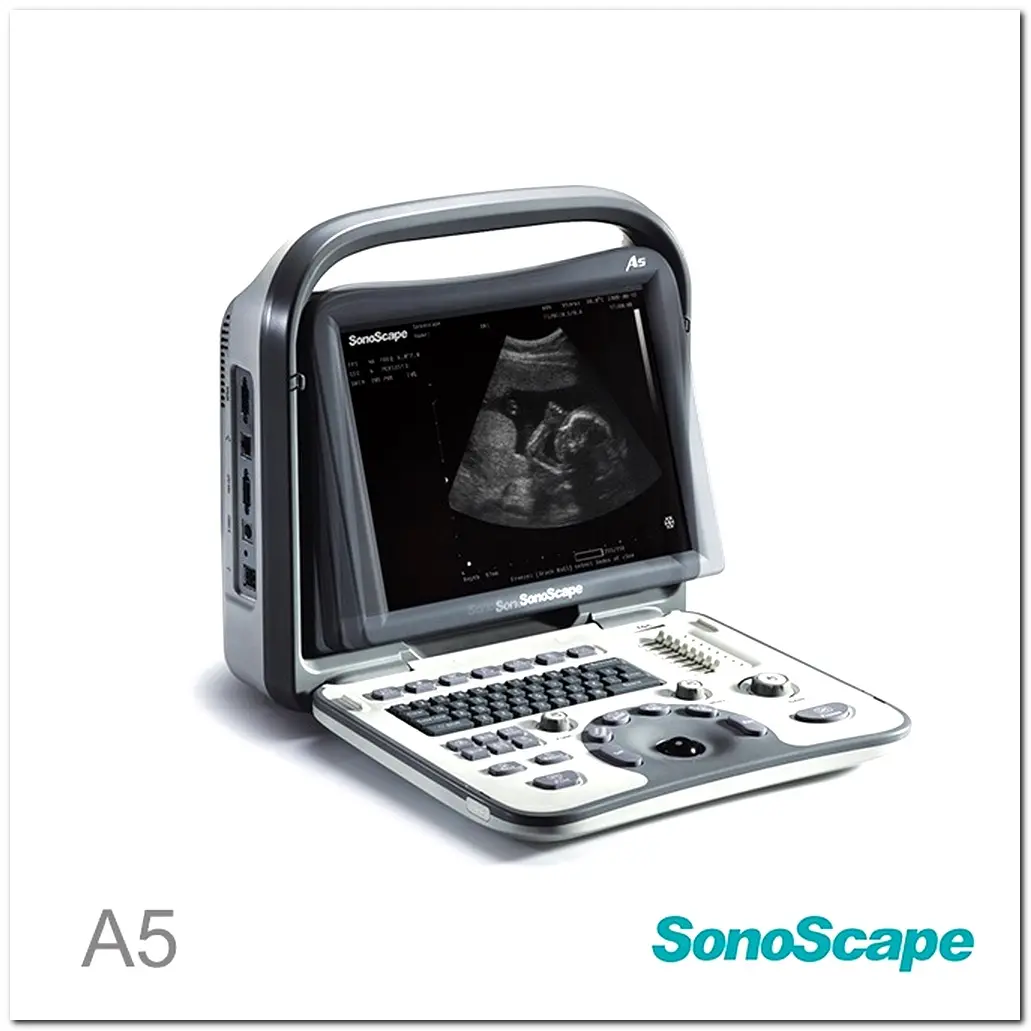 MONKON Colour Doppler Ultrasound in Pregnancy 3