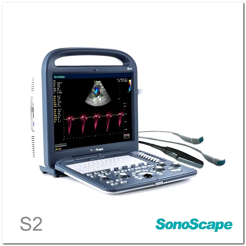 MONKON Colour Doppler Ultrasound in Pregnancy 4