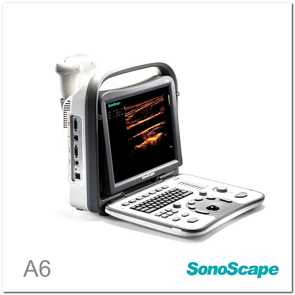 MONKON Colour Doppler Ultrasound in Pregnancy 5