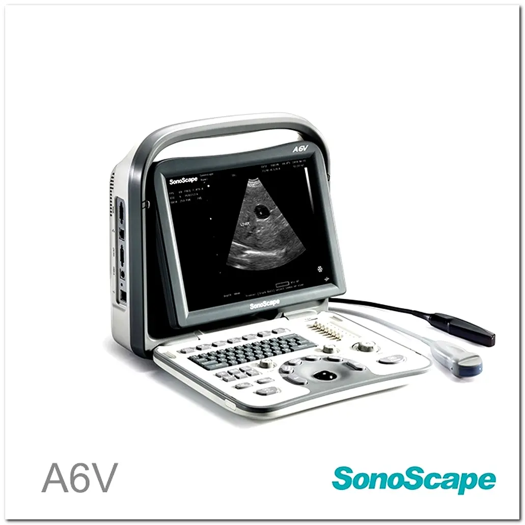 MONKON Colour Doppler Ultrasound in Pregnancy 6
