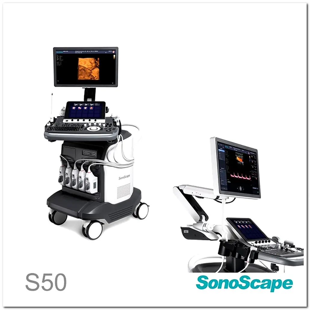 MONKON Colour Doppler Ultrasound in Pregnancy 8