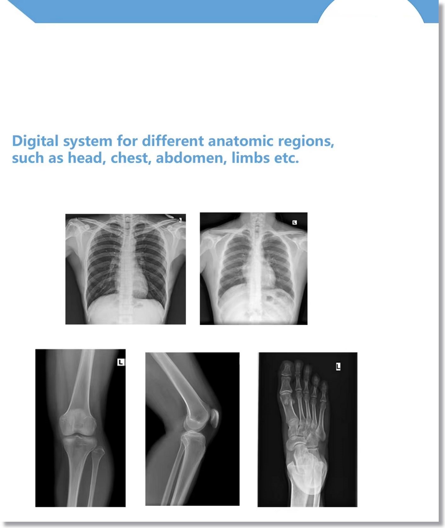 High Frequency Generator Medical X-ray Imaging Equipment