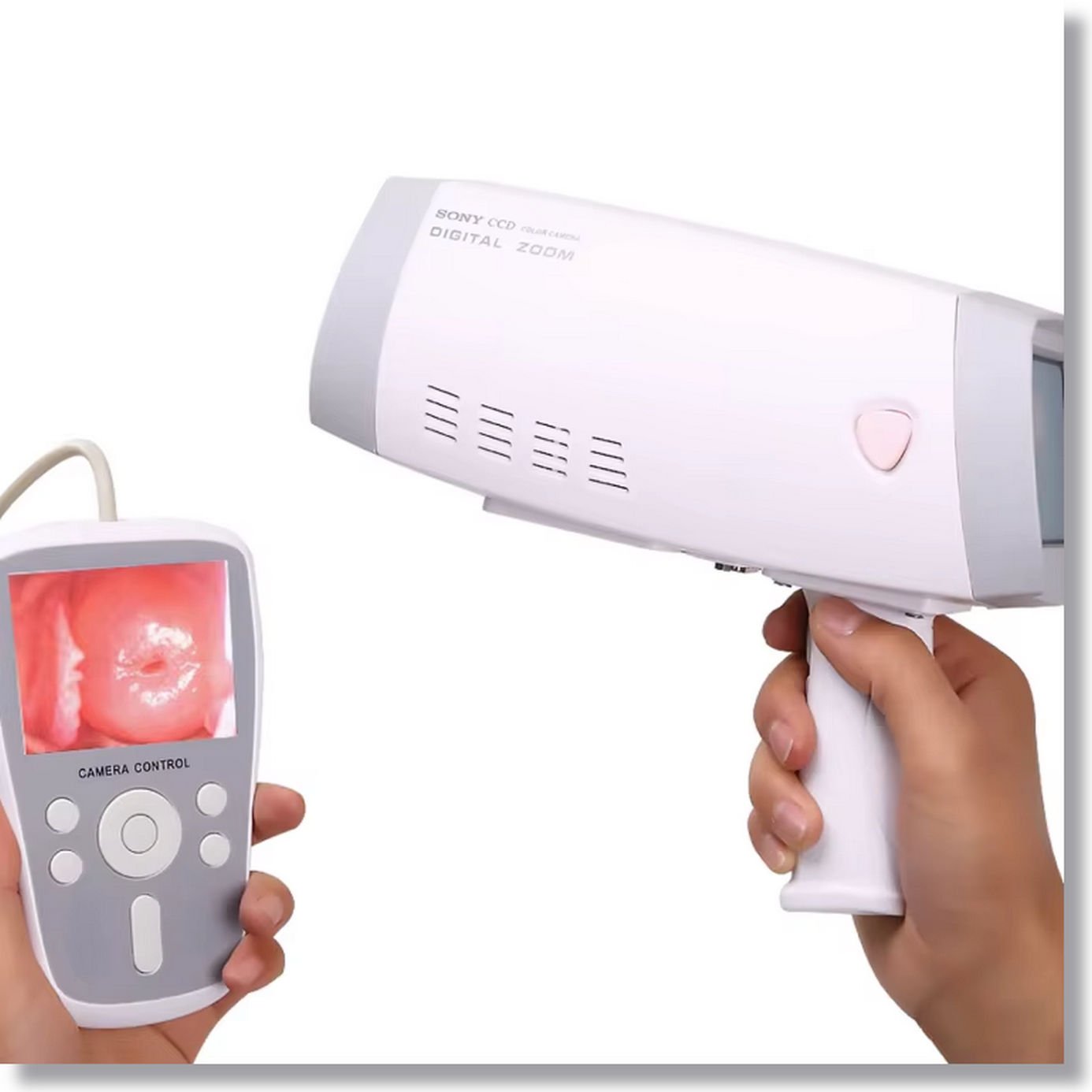 Portable Digital Beautiful Vagina Video Colposcope