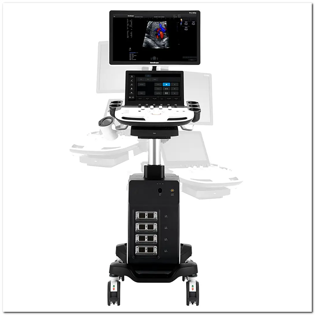 Sonoscape P11 Elite OB Trolley 4D Color Doppler Ultrasound Machine ...