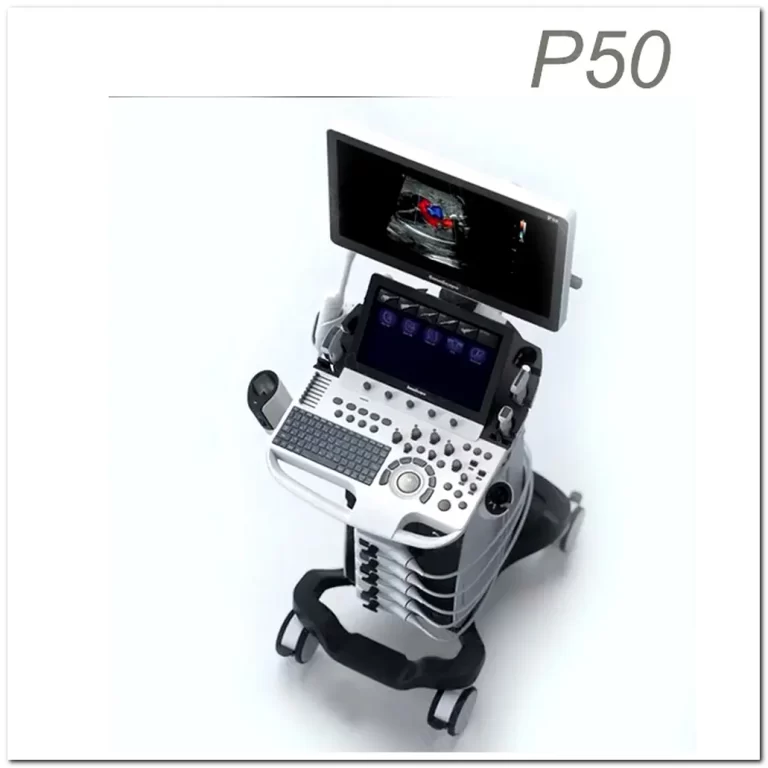 Sonoscape P50 4D Scan Ultrasound Machine: Revolutionizing Diagnostic Imaging 5 Sonoscape p50 4d scan ultrasound machine 2