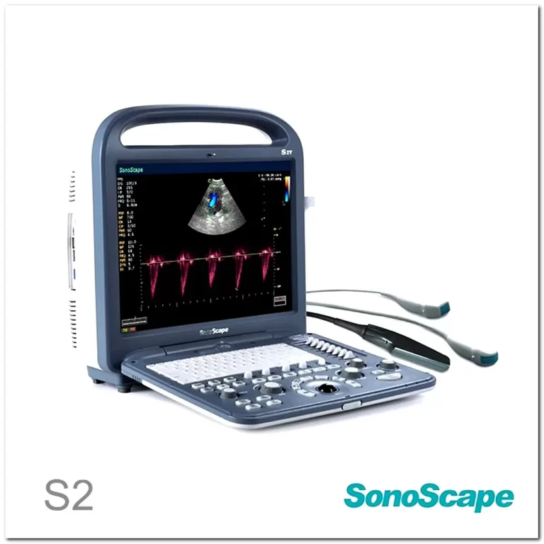 MONKON Colour Doppler Ultrasound in Pregnancy 1 MONKON Colour Doppler Ultrasound in Pregnancy 4
