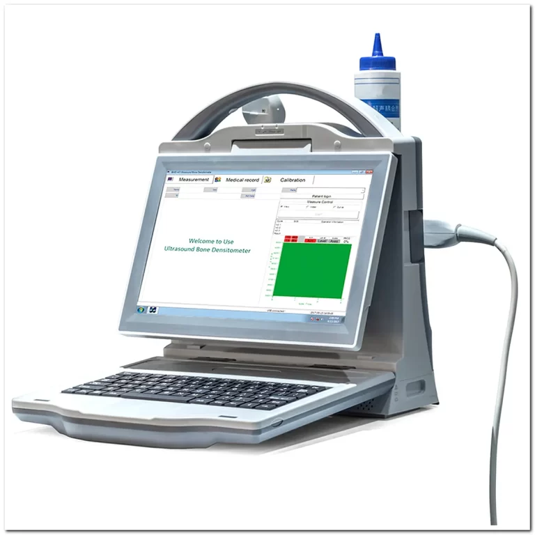 MONKON Portable Ultrasound Bone Densitometer Bone Density Scan Price 7 MONKON Portable Ultrasound Bone Densitometer Bone Density Scan Price 4